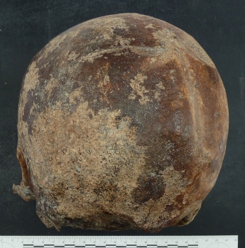 cranio